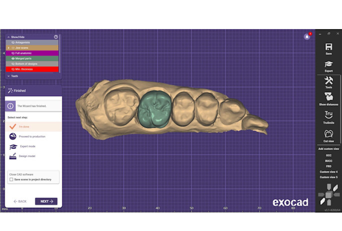design high precision vitalium framework for partial denture